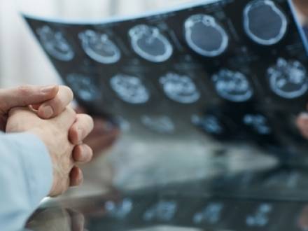 Rockford, IL Brain Injury Attorneys